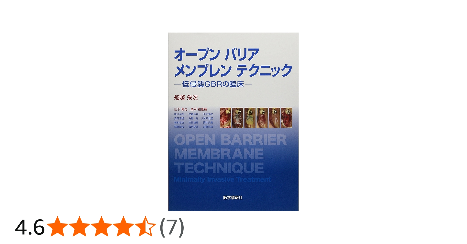 Amazon.co.jp: オープンバリアメンブレンテクニック: 低侵襲GBRの臨床
